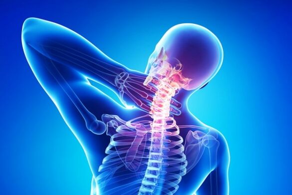 Osteochondrose