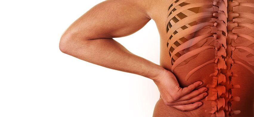 Symptome einer lumbalen Osteochondrose